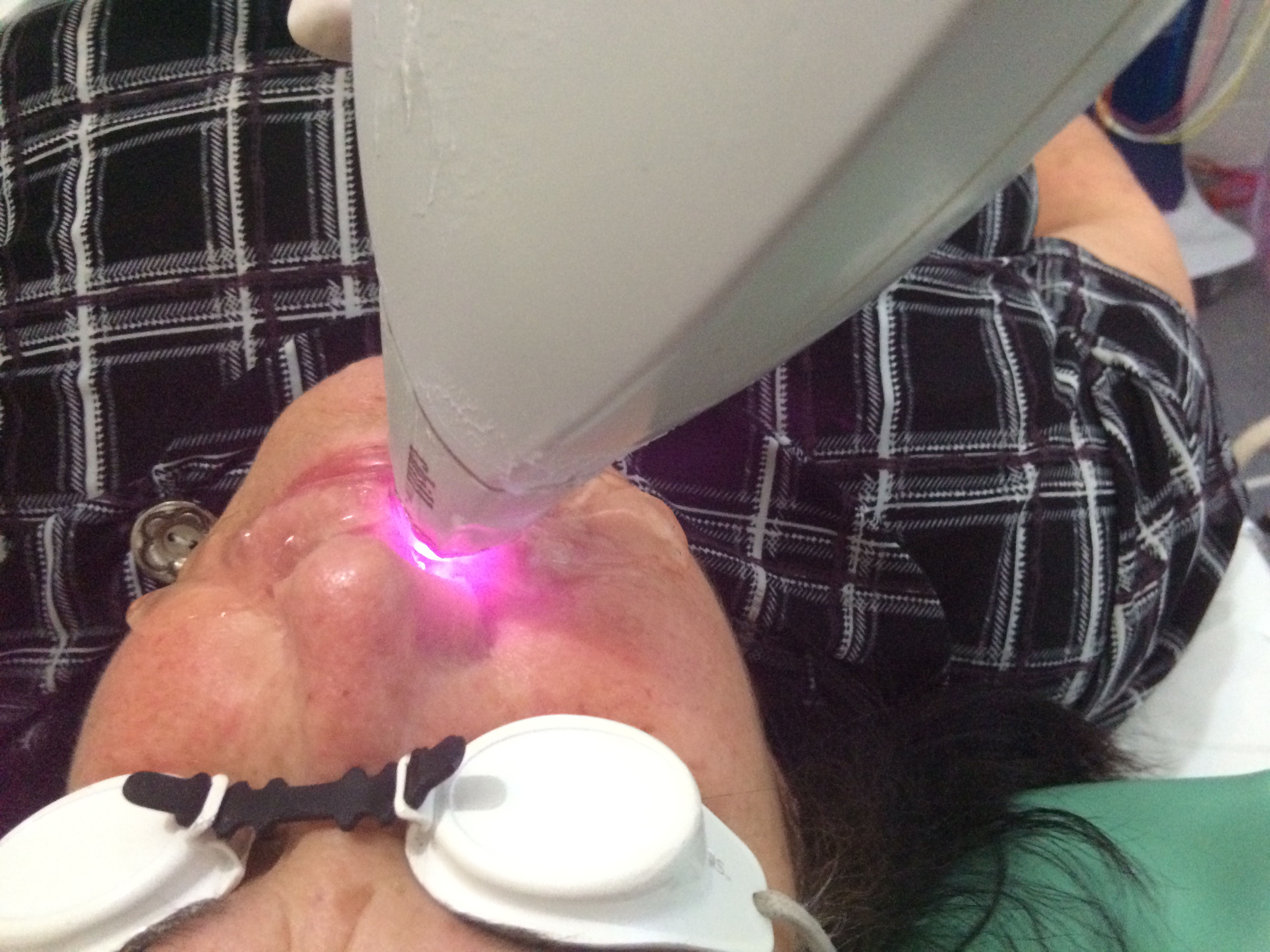 Galeria Depilação a Laser 1