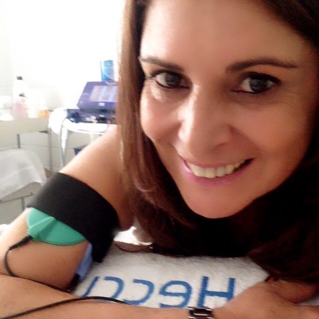 Esteticista também se cuida!!!🚺💃🏻🙍🏻
Adoro a corrente aussie❤️
A corrente aussie é um estímulo elétrico usado para produzir uma contração muscular no local em que ele é aplicado. Com isso, pode haver melhora no tônus muscular e na flacidez da pele, além de estimular a circulação sanguínea e linfática e a oxigenação celular, trazendo bons resultados.😀
#fortalecimento
#musculos 
#flacidez 
#autoestima