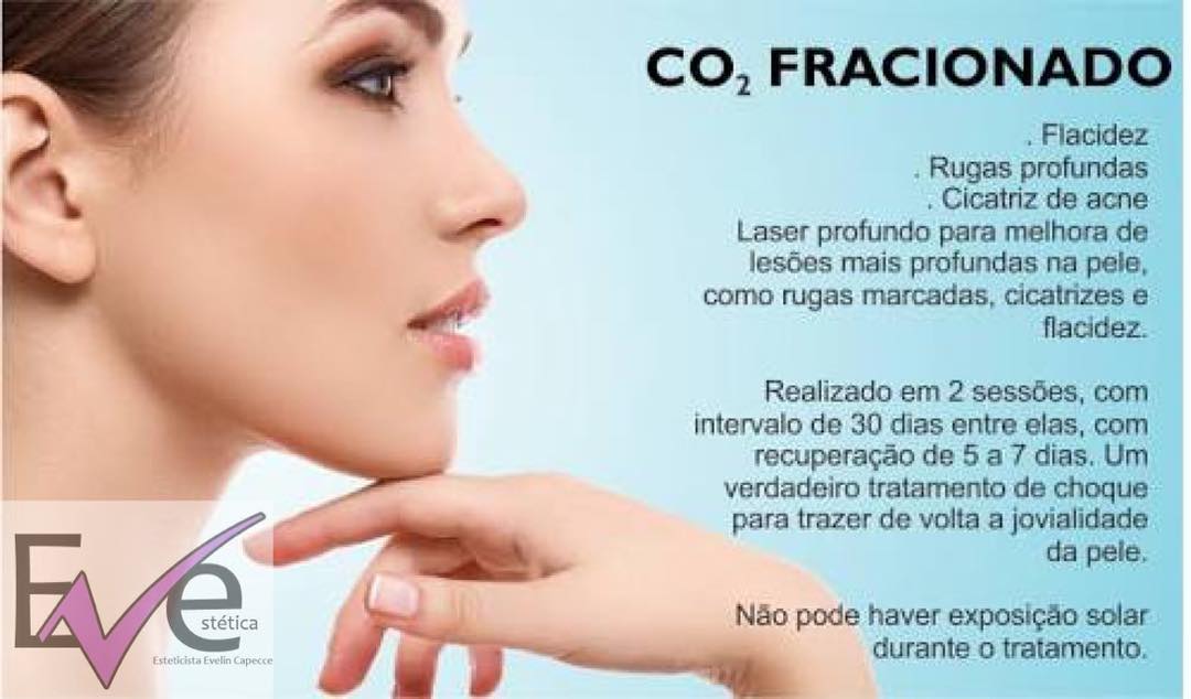 Mega Promoção – CO2 FRACIONADO
Avaliação Gratuita

O laser CO2 fracionado é indicado para pessoas que buscam rejuvenescimento da pele, remoção de cicatrizes em geral (como de acne) e estrias, ou o fim da flacidez. Ele é excelente para rugas, pois consegue atingir diversas superfícies da pele, nivelando sua estrutura. Além disso, como o laser CO2 total, ele estimula a produção de colágeno nas áreas em que agride a pele, dando a elas uma aparência mais jovem.

Qualidade e Segurança, Você encontra na  Eve Estética.

Horários Limitados.Reserve o seu!! Agende já o seu horário 3534 0031 – Rua Marmará, 226 Jd do Mar – SBC
#co2fracionado 
#semaninhas #flacidezdepele 
#estriasnagravidez #estriasbrancas ABC