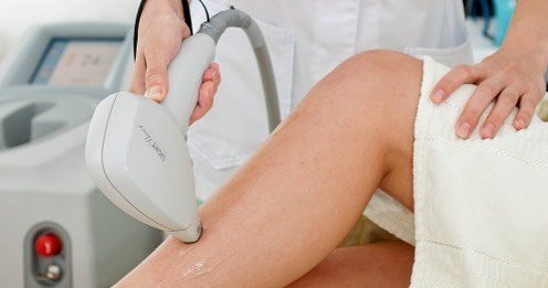 Sol x laser: Com a chegada do verão, todo cuidado é pouco.
Amanhã nossa última sessão de Depilação a Laser, daremos uma pausa para vcs aproveitarem o verão !!! ☀️️ Mas com a chegada do verão quem vai se submeter à depilação a laser deve redobrar os cuidados. Antes, vale a pena saber que é importante evitar totalmente a exposição solar. “O alvo do laser é o pigmento do pelo. Em 90% dos casos de queimadura, observo que a pessoa estava com a pele bronzeada ao usar o laser. Por isso, só pode começar quem está há cerca de um mês sem tomar sol”, #simplesassim #eveesteticasaobernardodocampo #depilação #laser#sempelos #pelosencravadosnuncamais #verao2017