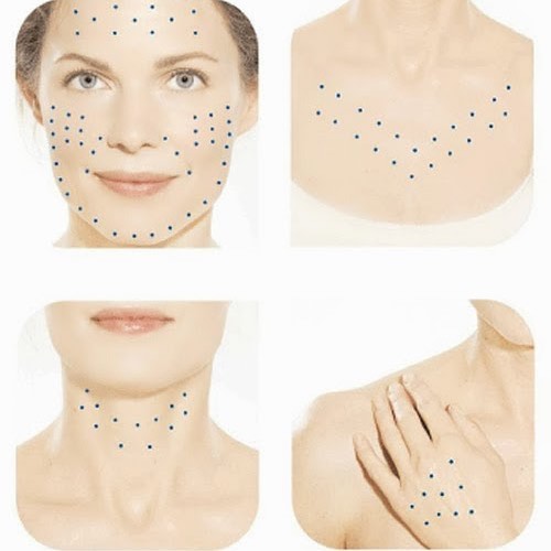 A técnica conhecida como Skinbooster é uma grande novidade para tratamento da pele. Com esse tratamento é possível oferecer uma hidratação profunda e mais completa para a pele. Basicamente nesse tratamento são utilizadas injeções na pele, porém, não com o objetivo de criar volume como no do botox e sim de oferecer uma hidratação imediata.
Ácido Hialurônico de Baixa Concentração
A substância que é injetada é uma combinação de ácido hialurônico de baixa concentração com outras substâncias que auxiliam na hidratação imediata. O resultado do Skinbooster é uma pele mais jovem com um visual mais saudável. Apesar de relativamente novo no meio dermatológico esse tratamento já é reconhecido por sua eficácia e por não oferecer riscos.
Pode ser aplicado rosto, colo, pescoço e mãos… A aplicação é feita uma vez por mês. 
#venhaficarlinda #pelebonita #mãosdediva #colosemrugas #esteticafacial #evestetambém