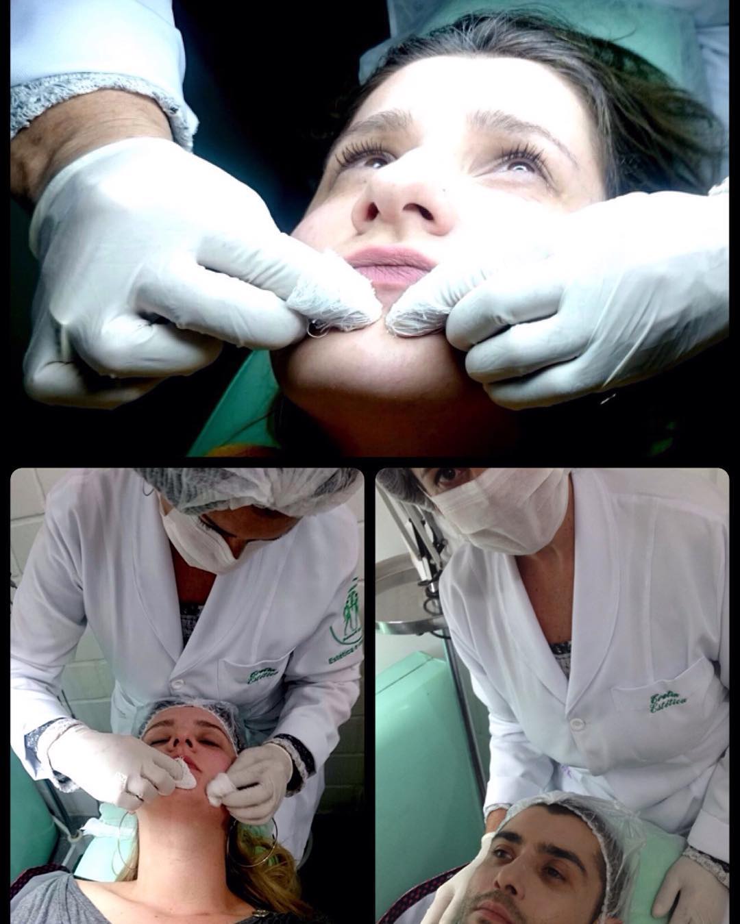 A limpeza de pele é um dos serviços mais buscados em consultórios e clínicas , já que, além de fazer o que se propõe – limpar a cútis -, traz benefícios como remoção das células mortas, promovendo uma pele renovada, lisinha e livre dos sinais da acne, como cravos e espinhas. 
Já fez a sua esse mês?
#acne #celulasmortas #peleoleosanuncamais #porosfechados #semmarcasdeacne #sembrilho #pelelinda #vemfazerparte