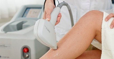 Dia 26/07/17 tem Depilação a Laser…💃🏻 O Light Sheer  é um dos melhores lasers para depilação. O laser é de diodo. Ele atinge o pelo em formação e o destrói, assim quando esse aquecimento atinge as células da raiz, o pelo para de crescer e é só alegria. Esse tratamento reduz definitivamente mais de 90% dos pelos com 6 sessões em média dependendo da área tratada, cor da pele e quantidade de pelos. Quanto mais clara a pele e mais escuros os pelos, mais sucesso no resultado. 
E nossa promoção continua virilha total 89,90
Agende sua avaliação…📲💃🏻
#depilacaoalaser #veraochegando #sempêlos #aindadatempo #estetica#promoçãodeinverno #pelesemfoliculite