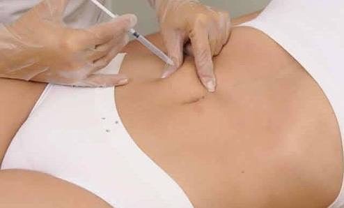 Que tal aproveita o VERÃO na melhor forma? 😍💓🏖🏝⛱🌞☀
Pensando nisso, preparamos um pacote especial focado em redução de GORDURA LOCALIZADA para você: Oito aplicações de LIPO ENZIMÁTICA com 30% de desconto!
A Lipo Enzimática consiste na aplicação de enzimas por meio de injeções com agulhas finas, as quais promovem a redução da gordura localizada. A enzima possibilita a quebra de moléculas de gordura, assim como a sua redução significativa.

Para saber mais sobre valores e condições de pagamento pelo Whats app .(11) 984765009☎

#semprebela #saudeebemestar #eveestetica #xogordurinhas